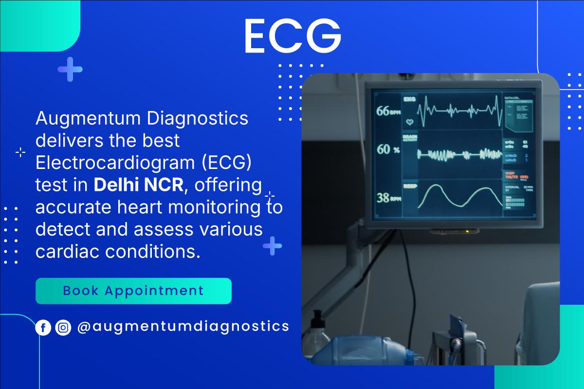 ECG Service