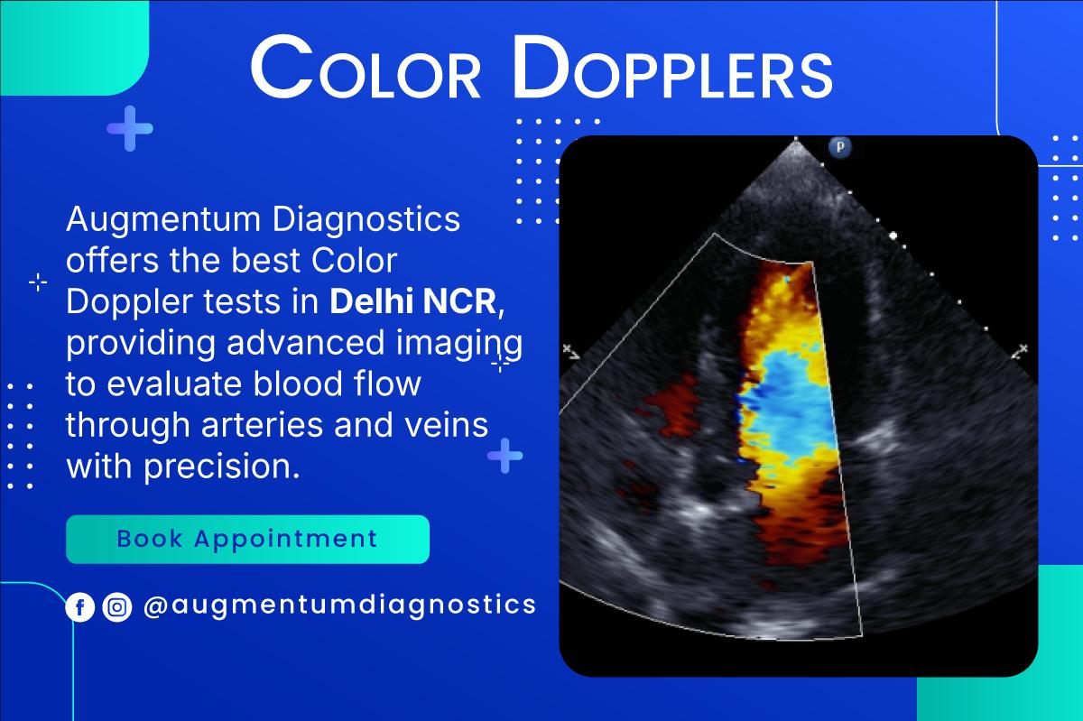 Color-Doppler-img