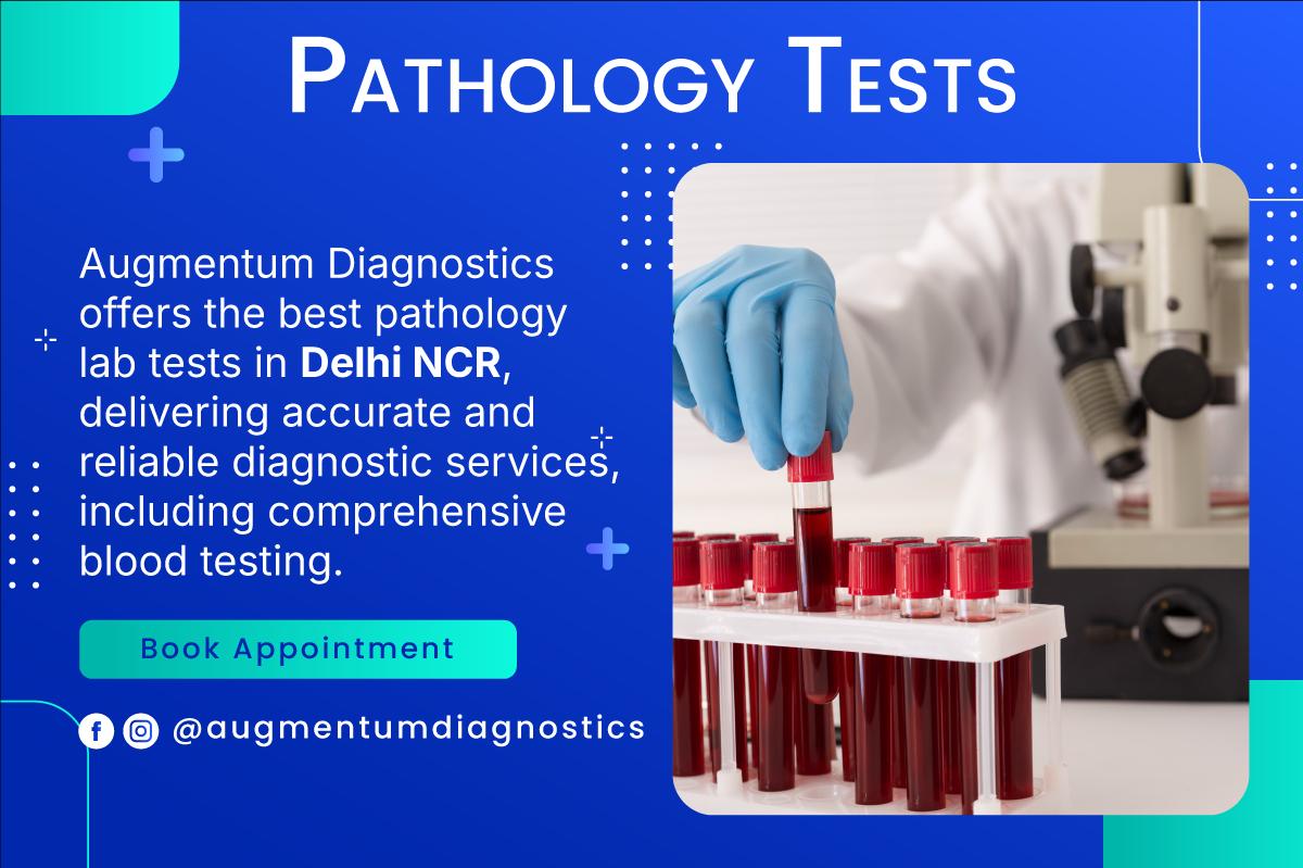 Pathology-tests-test-img